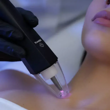 Load image into Gallery viewer, Zemits EvoPlasm Cold Plasma Technology