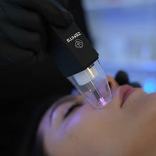 Load image into Gallery viewer, Zemits EvoPlasm Cold Plasma Technology
